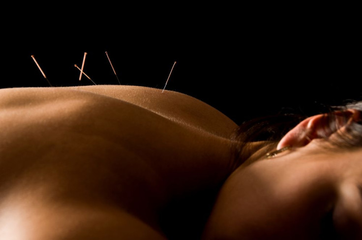 Acupunture May Relieve Hot Flash Symptoms For Menopausal Women