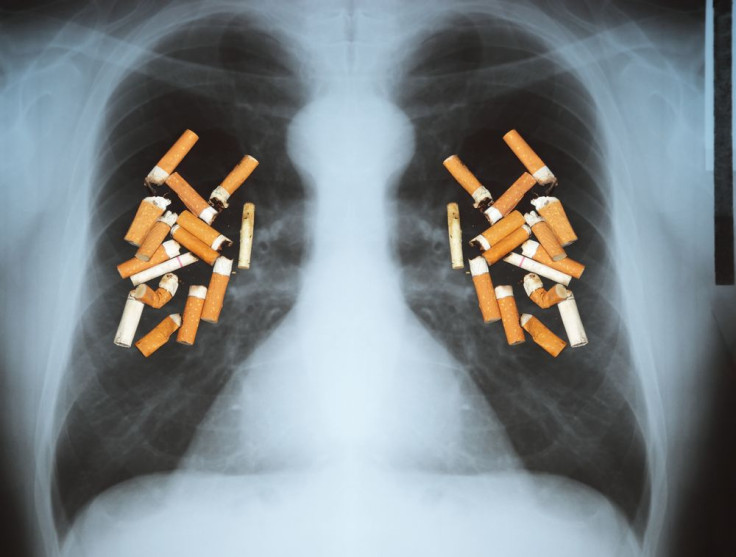 Lung Cancer