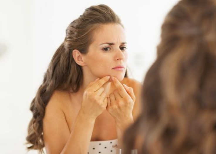 Pimple Popping Myths And Other Acne Questions Are Answered