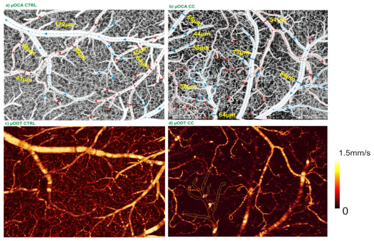 bloodvessels