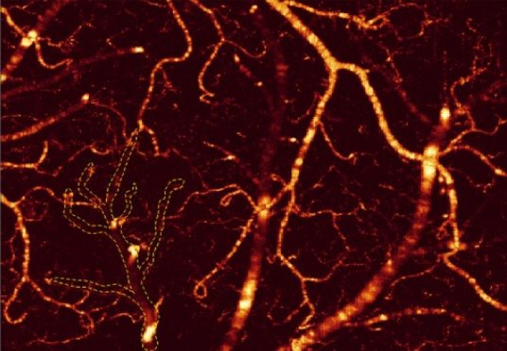 bloodvessels