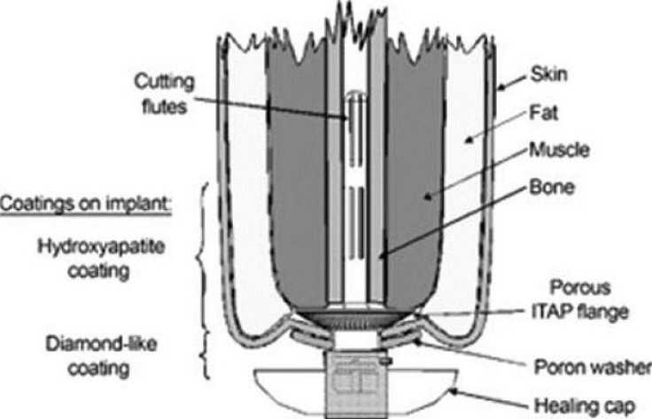 prosthetic2