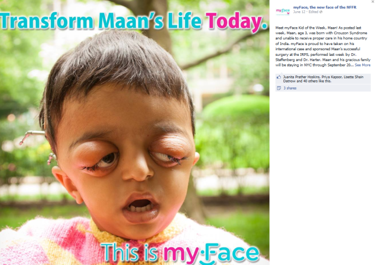 Maan before surgery in June