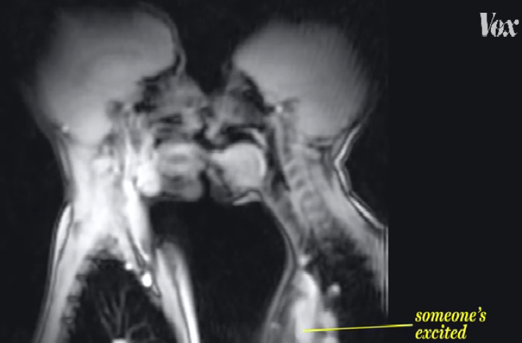 MRI scan of people kissing