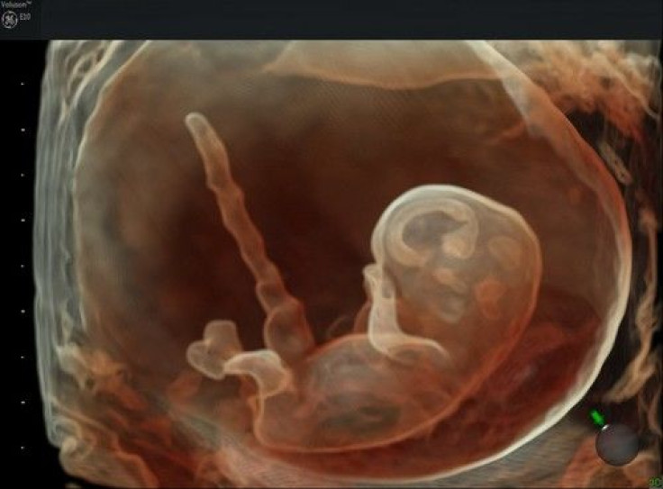 9 week fetus