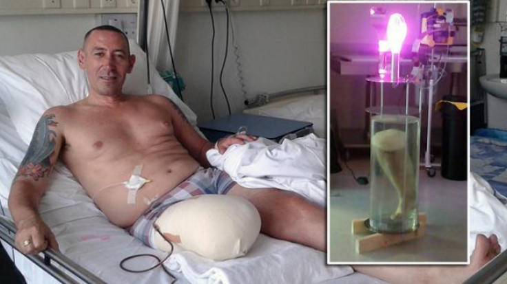 Man makes amputated leg into real-life lamp 