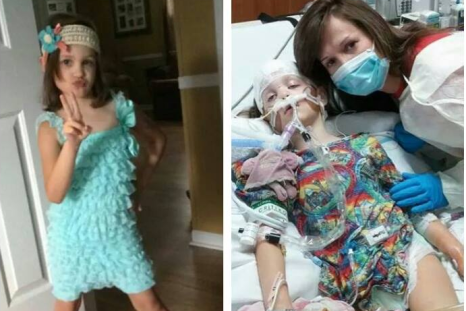 5-year-old girl becomes paralyzed in less than a week after developing enterovirus 68.