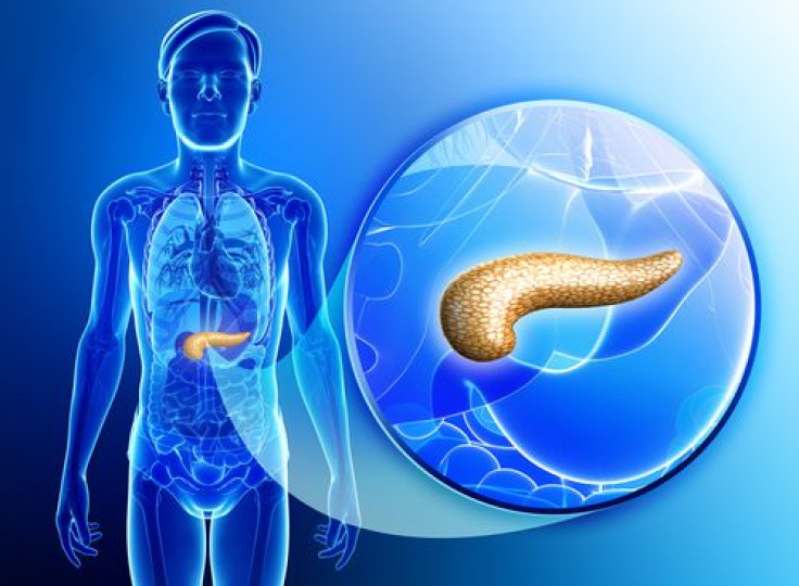 Pancreatic cancer risks