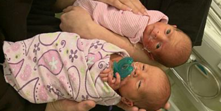 Woman with stomach pains gives surprise birth to mono-mono twin girls