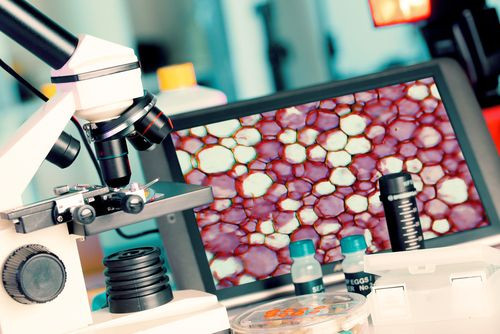 Biopsy