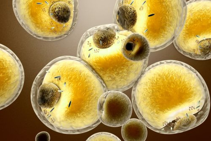 Brown Fat Cells Fight Obesity And Type 2 Diabetes