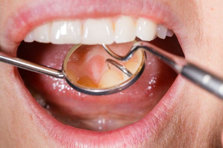 Oral Cavities