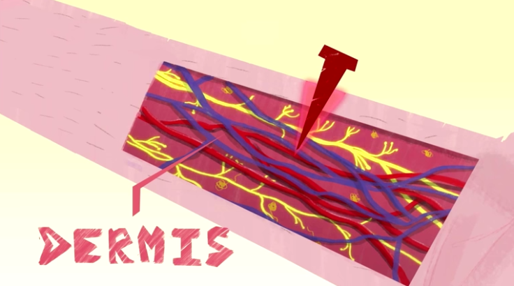 dermis