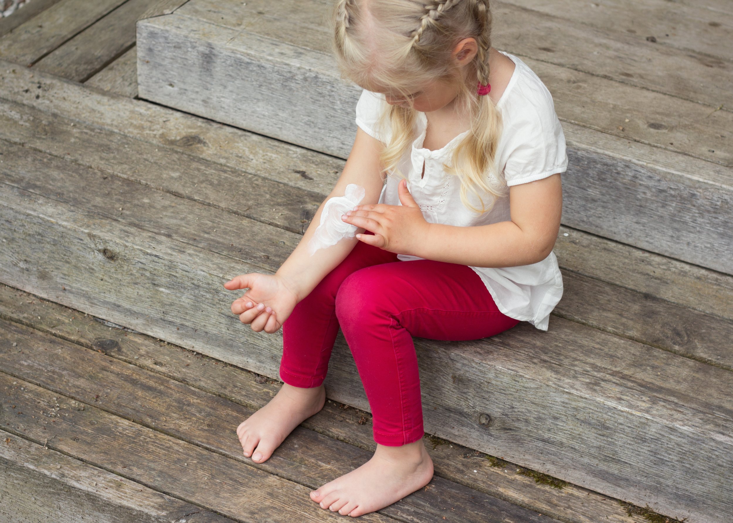Kids With Eczema Arent Safe With Allergen-Free Lotions