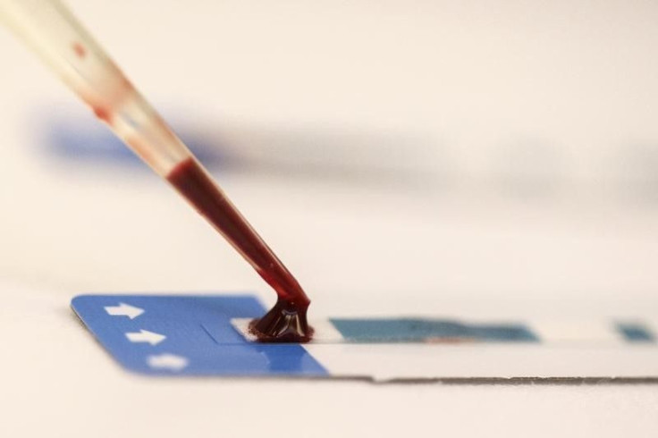 HIV under control