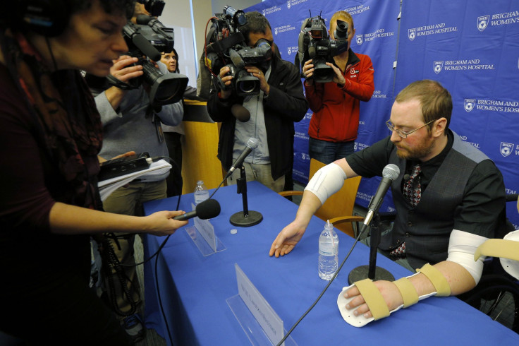 double arm transplant