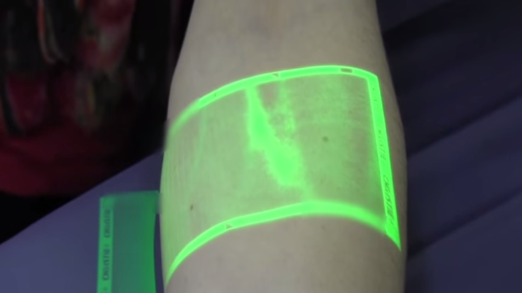 Vein Visualization Technology