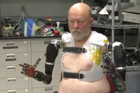 Leslie Baugh has been fitted with two modular prosthetic limbs 40 years after losing his arms in an electrical accident. He says being able to control an arm sends him 
