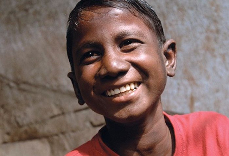 Boy with leprosy