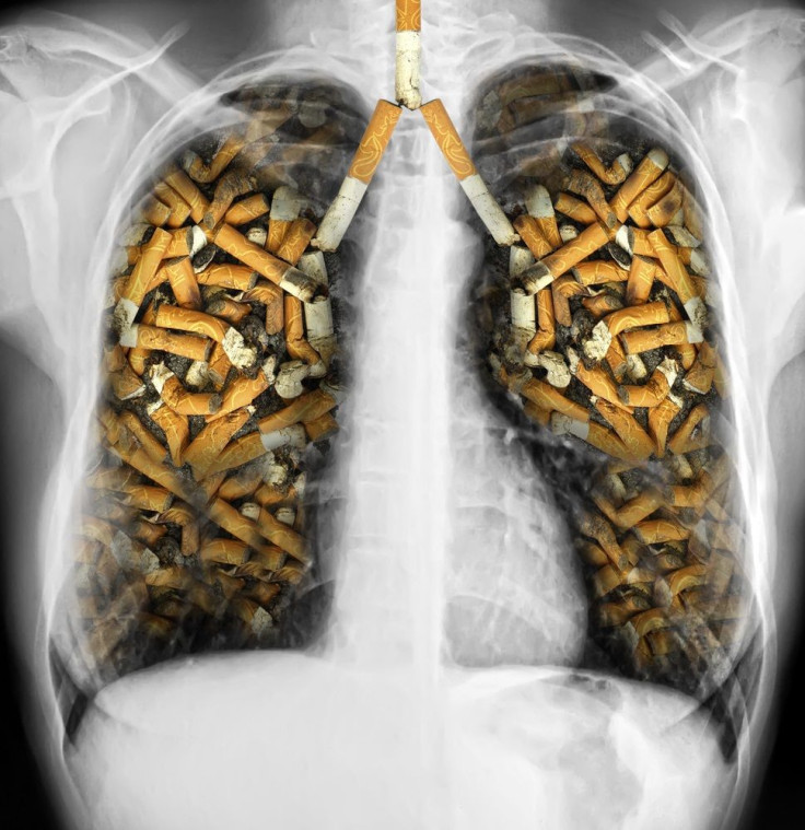 Smokers' Lungs