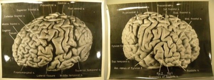 Einstein's Brain Photographs