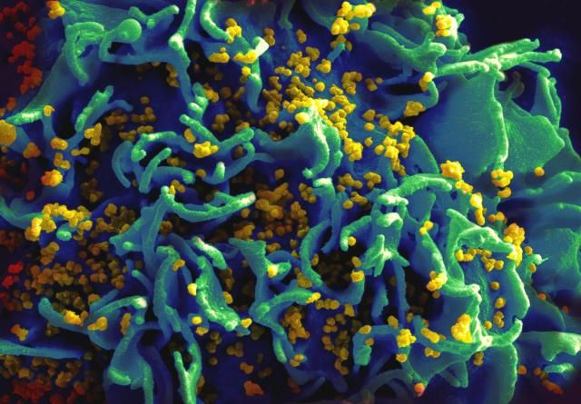 HIV infected t-cell