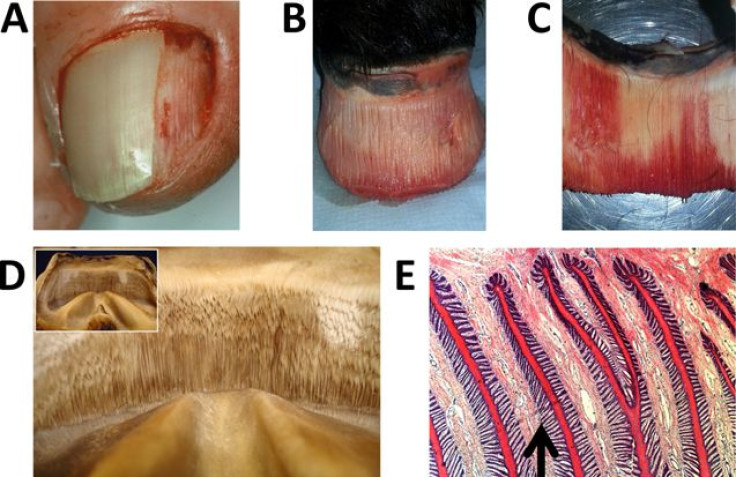 Anatomy of nail and hoof adhesion.