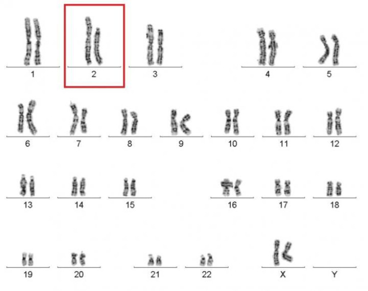 chromosomes