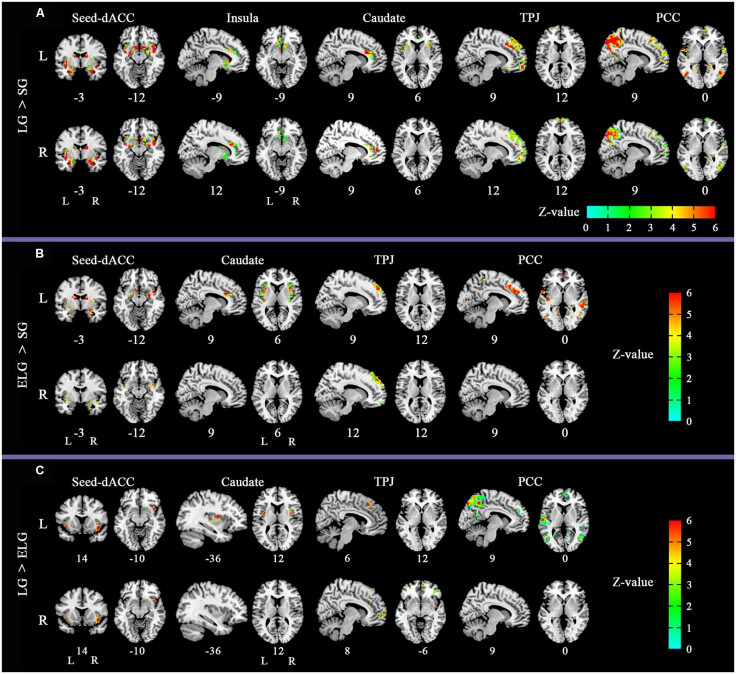Brain scans across all three groups