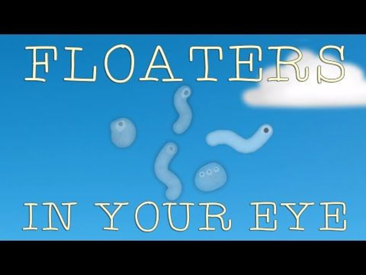 What Are Floaters? The Science Behind Those Strange Floating Objects