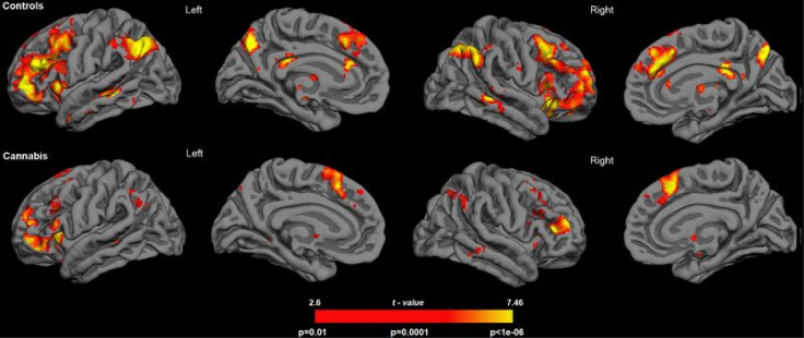 Rendering of fMRI results for each participant group