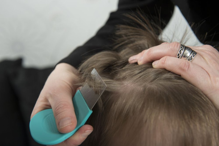 lice on a child's head