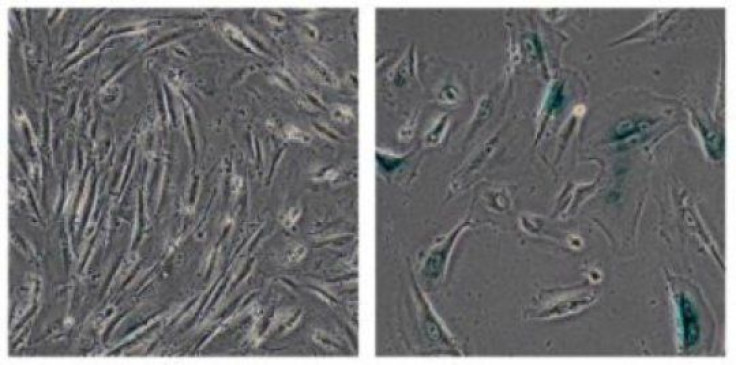 Healthy cells vs. cells lacking gene