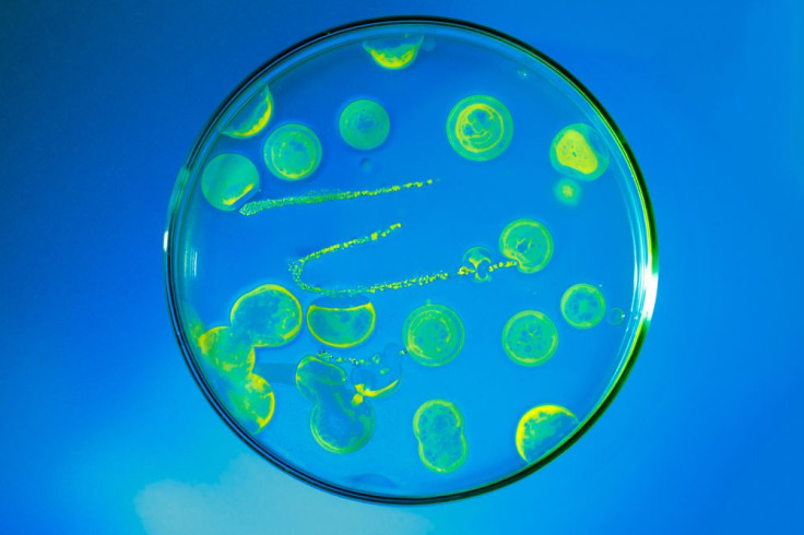 bacteria culture