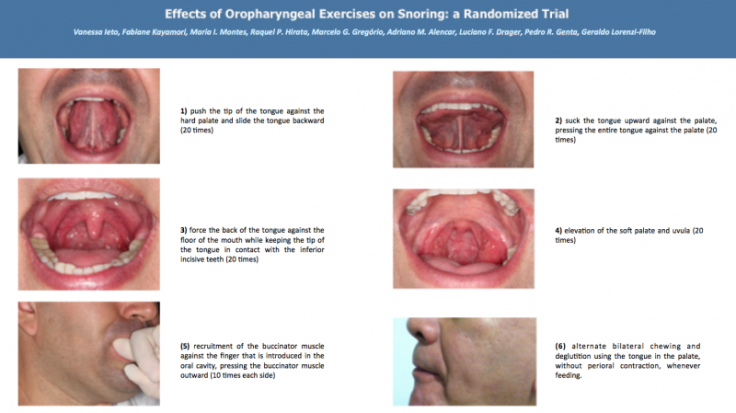 Effects of oropharyngeal exercises on snoring 