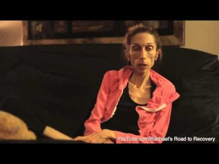 California Woman With Anorexia, Rachael Farrokh, Makes Public Appeal To Help Save Her Life