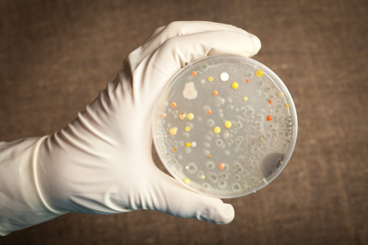 Anthrax in petri dish