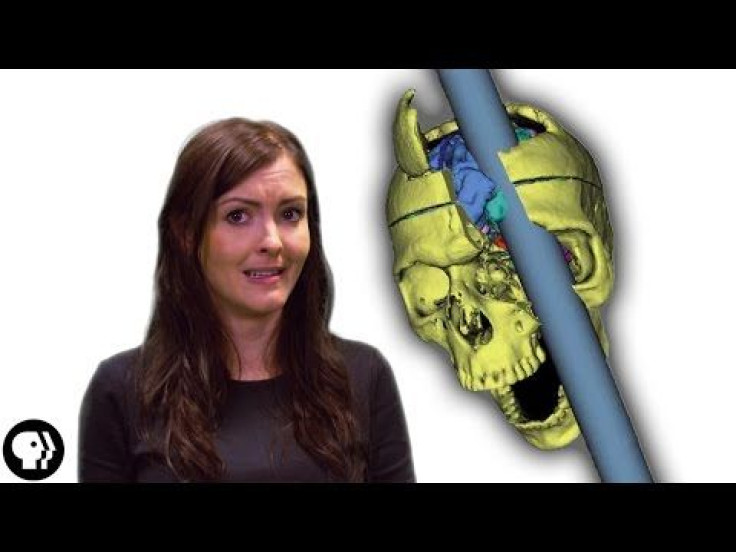 Phineas Gage: How The Man With A Hole In His Brain Survived His Gruesome Ordeal