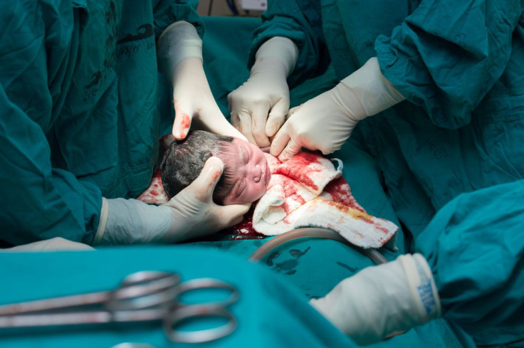 c-section