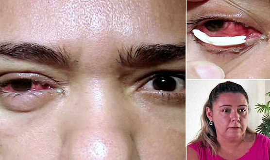 Rare eye problem