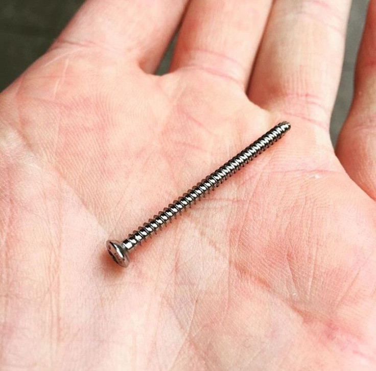 Screw removed