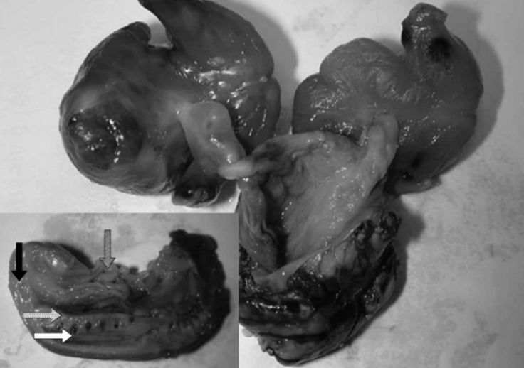 fetus 3