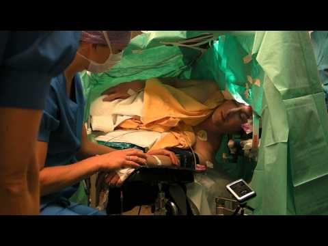 Professional Opera Singer With Glioblastoma Multiforme Sings Schubert's 'Gute Nacht' While Having A Craniotomy