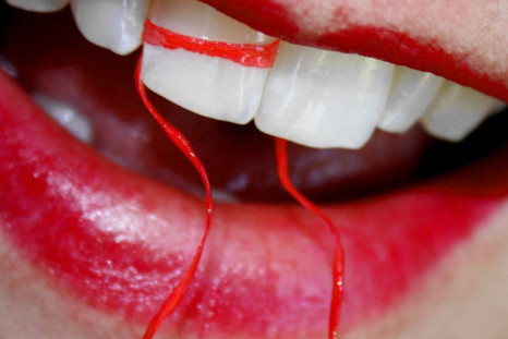 A woman in Wisconsin developed a knee infection from flossing too much.