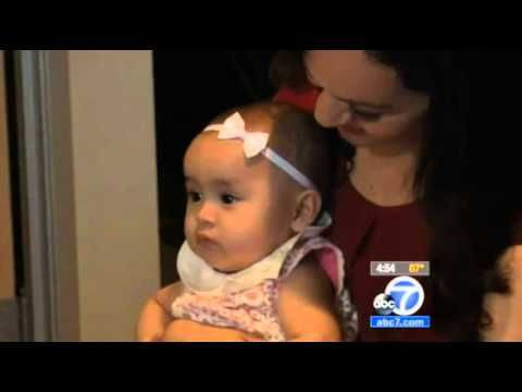 Hearing Aids Help These Identical Twins Hear Their Parents' Voice For The First Time