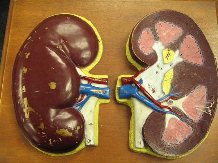 Kidney