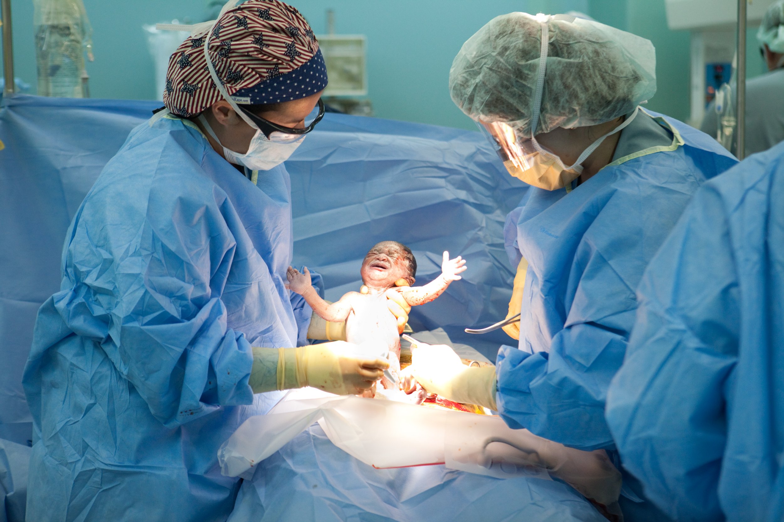 Things to Know about C-section