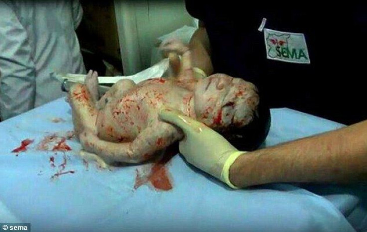 Syrian baby Amel
