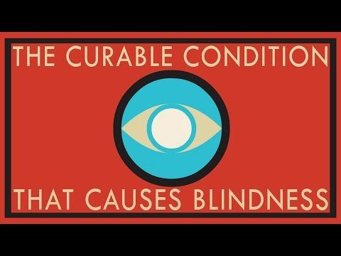 The Extensive (And Often Grotesque) History Of Cataract Treatment And How We Can Restore Sight To Millions