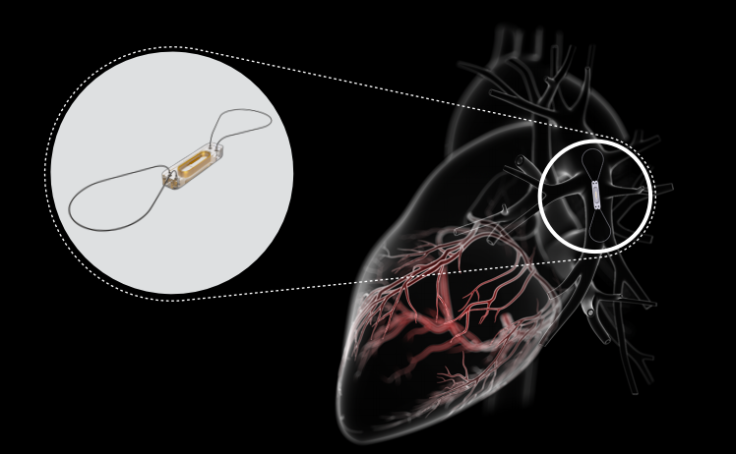 CardioMEMS